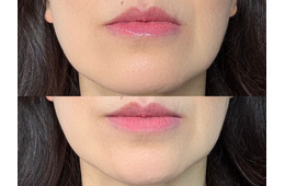 40・50代が老けて見えるのはリップの色のせい？オバ見えリップの特徴【2025年度ベスト記事セレクション】