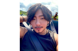 カマたく、人中短縮＆眉下切開整形のビフォーアフター公開「印象ぜんぜん違う」「努力がすごすぎる」の声