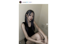 「月曜から夜ふかし」多田さん「むくみや腫れはかなり残る」両顎整形手術からDT21日目のリアルな姿公開「本当に大変そうで心配」の声