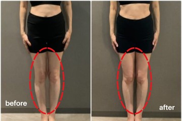【寝たまま１分！骨盤矯正】骨盤のゆがみを整えて、O脚から真っ直ぐ足に【鬼軍曹ゆか様ダイエット】 画像