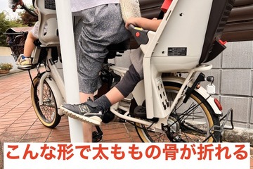 子供乗せ自転車、幼児の太もも骨折が多発…日本小児救急医学会 画像