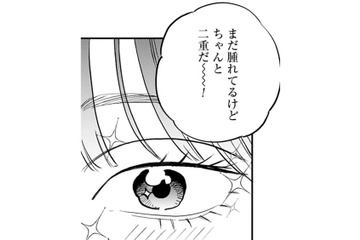 「本物だ！」ついにやった二重整形。アイテープとは違った感動を覚えて…【Dressing　美容外科医　森野まりあ #18】 画像