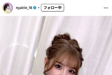 “整形総額2600万円”人気インフルエンサー・平瀬あいり、ビフォーアフター＆施術内容公開で驚きの声「努力がすごすぎる」「別人みたい」 画像