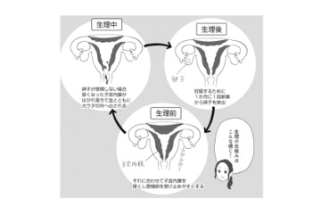 月経痛と過多月経の緩和に効果的なピル。10代でピルを服用するメリットは？【産婦人科医に聞く わたしとカラダの選択肢  #９】 画像