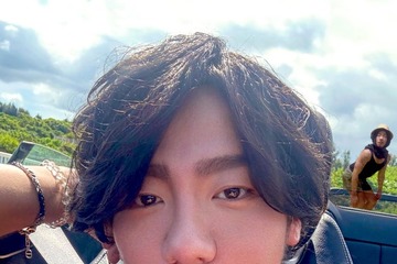 カマたく、人中短縮＆眉下切開整形のビフォーアフター公開「印象ぜんぜん違う」「努力がすごすぎる」の声 画像