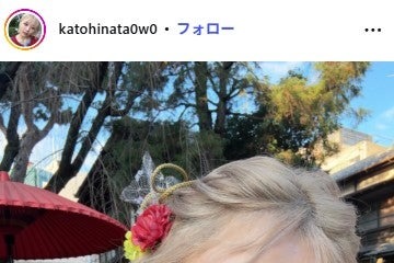 “B→Fカップにバストアップ”話題の美人YouTuber、歯列矯正のビフォアフ公開「別人級」「フェイスラインが違う」と驚きの声 画像