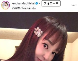 神田うの、薄毛治療を公表 施術の様子公開「オデコ（前髪）だけが薄い問題」 画像