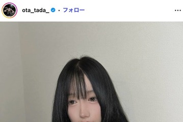 「月曜から夜ふかし」多田さん「残り10日で術後1ヶ月です」ノーマルカメラで整形DTの経過報告「強さに感動」「早く良くなりますように」と反響 画像