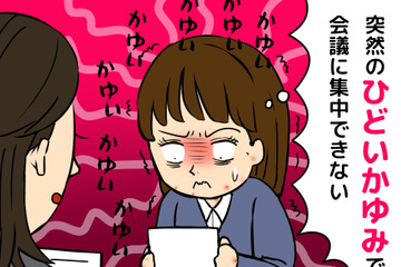 蕁麻疹も更年期のサイン⁉突然襲ってきた「かゆみ地獄」の原因と対処法 画像