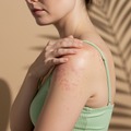 大人になってから発症・再燃することも。40代・50代のアトピー性皮膚炎【専門家監修】 画像