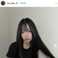 「月曜から夜ふかし」多田さん「残り10日で術後1ヶ月です」ノーマルカメラで整形DTの経過報告「強さに感動」「早く良くなりますように」と反響 画像