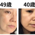 40代で肌年齢−14歳！ 美容医療なしで「40歳より透明感が出た」49歳美容ライターがリピ買いする美容成分TOP2