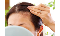 「抜け毛」が増えるのは、季節の変わり目のせい？ストレスのせい？「育毛鍼灸師が教える「異常信号」と、髪を生やすためにできること 画像