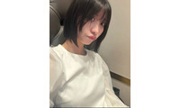 元SDN48メンバー、肝臓に腫瘍「しかも4つも」医師からの注意も明かす 画像