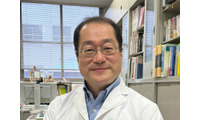 更年期は「体臭の曲がり角」！？40代以降は「ニオイがきつくなる」５つの原因とは【皮膚ガス研究の第一人者が解説】 画像