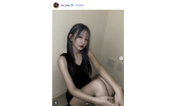 「月曜から夜ふかし」多田さん「腫れがしぶといよ」両顎・輪郭手術から1ヶ月の経過報告「かなり良くなってきてますね」 画像