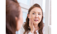 「シミ・シワ・たるみ」だけじゃない！ピリピリ痛む、ムズムズする…更年期に増える肌の違和感、原因は女性ホルモン？肌への影響を専門医が解説 画像