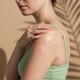 大人になってから発症・再燃することも。40代・50代のアトピー性皮膚炎【専門家監修】 画像